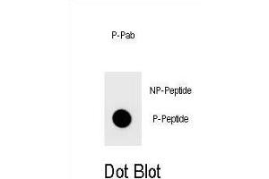 Dot blot analysis of Phospho-TOPBP1- Antibody Phospho-specific Pab (ABIN1539690 and ABIN2839840) on nitrocellulose membrane. (TOPBP1 抗体  (pSer1159))