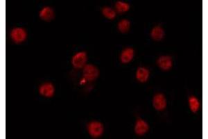 ABIN6266721 staining Hela by IF/ICC. (Musculin 抗体  (Internal Region))
