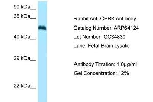 Western Blotting (WB) image for anti-Ceramide Kinase (CERK) (C-Term) antibody (ABIN970379) (CERK 抗体  (C-Term))