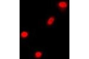 Immunofluorescent analysis of Cbl-3 staining in A549 cells. (CBLC 抗体)
