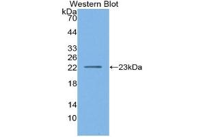 Western blot analysis of the recombinant protein. (Lipase A 抗体  (AA 32-201))