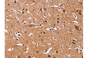 The image on the left is immunohistochemistry of paraffin-embedded Human brain tissue using ABIN7128938(CHRM1 Antibody) at dilution 1/20, on the right is treated with fusion protein. (CHRM1 抗体)