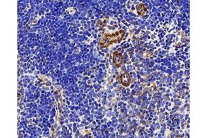 Immunohistochemistry analysis of paraffin-embedded mouse thymus using LDLR Polyclonal Antibody at dilution of 1:300. (LDLR 抗体)
