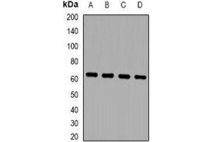 Western blot analysis of ZNF307 expression in MCF7 (A), HepG2 (B), mouse brain (C), mouse lung (D) whole cell lysates.