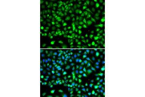 Immunofluorescence analysis of MCF-7 cells using SMYD1 antibody (ABIN6128707, ABIN6148163, ABIN6148165 and ABIN6219496). (SMYD1 抗体  (AA 1-350))