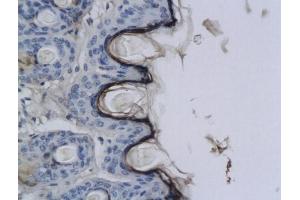 Formalin-fixed and paraffin embedded rat skin labeled with Anti-CNR2/CB2 Polyclonal Antibody, Unconjugated (ABIN680168) at 1:200 followed by conjugation to the secondary antibody and DAB staining. (CNR2 抗体  (AA 251-350))