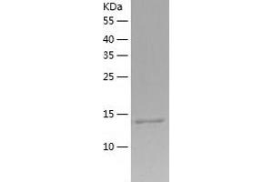 Western Blotting (WB) image for Cystatin C (CST3) (AA 27-146) protein (His-IF2DI Tag) (ABIN7122551)