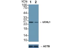 Knockout Varification: Lane 1: Wild-type A549 cell lysate, Lane 2: UCHL1 knockout A549 cell lysate, Predicted MW: 25kd Observed MW: 26kd Primary Ab: 1 μg/mL Rabbit Anti-Rat UCHL1 Antibody Second Ab: 0. (UCHL1 抗体  (AA 2-223))