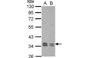 Western Blotting (WB) image for anti-Rab Geranylgeranyltransferase, beta Subunit (RABGGTB) antibody (ABIN2856206)