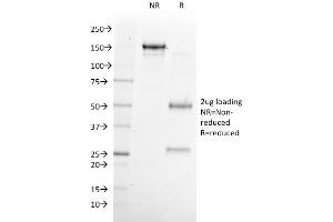 SDS-PAGE Analysis Purified NKX6. (NKX6-1 抗体)