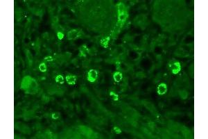Immunohistochemistry analysis using Mouse Anti-GABA A Receptor Monoclonal Antibody, Clone N95/35 (ABIN863139).