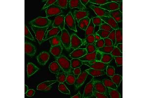 Immunofluorescence (IF) image for anti-Spectrin, Beta, Non-erythrocytic 2 (SPTBN2) (AA 356-475) antibody (ABIN6940654)