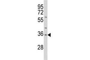 Western blot analysis of IL-1 antibody and HepG2 lysate.