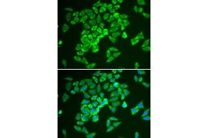 Immunofluorescence analysis of A549 cell using KEAP1 antibody. (KEAP1 抗体  (AA 325-624))