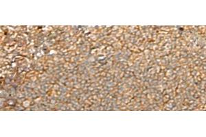 Immunohistochemistry of paraffin-embedded Human tonsil tissue using GNGT2 Polyclonal Antibody at dilution of 1:40(x200) (GNGT2 抗体)