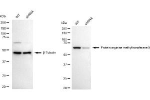 Western blotting analysis using protein arginine methyltransferase 5 antibody (ABIN7799971). (Recombinant PRMT5 抗体)