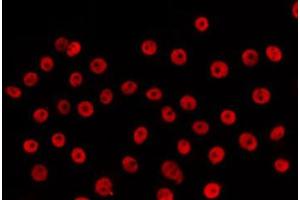 ABIN6266630 staining HepG2 by IF/ICC. (Retinoic Acid Receptor beta 抗体  (Internal Region))