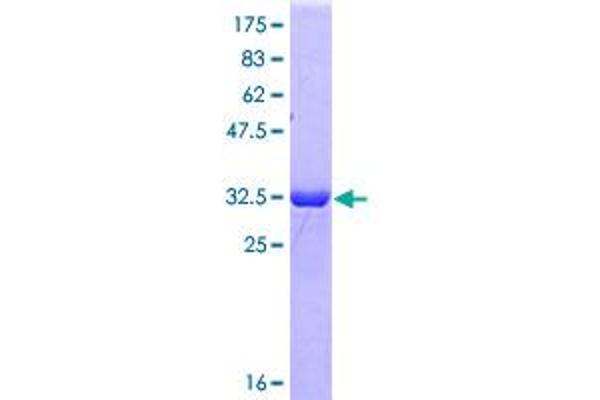 SRSF3 Protein (AA 1-85) (GST tag)
