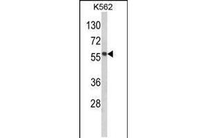 Western blot analysis of hMMP19-R359 in K562 cell line lysates (35ug/lane) (MMP19 抗体  (C-Term))