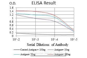 Black line: Control Antigen (100 ng), Purple line: Antigen(10 ng), Blue line: Antigen (50 ng), Red line: Antigen (100 ng), (ASS1 抗体)