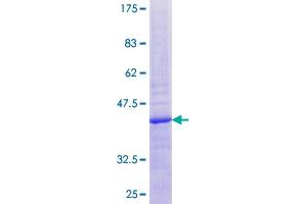 MRPL20 Protein (AA 1-149) (GST tag)