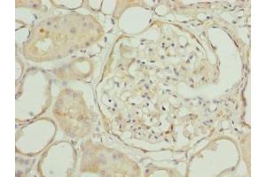 Immunohistochemistry of paraffin-embedded human kidney tissue using ABIN7151945 at dilution of 1:100 (EPM2AIP1 抗体  (AA 251-607))