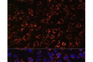 Immunofluorescence analysis of C6 cells using TOM20 Polyclonal Antibody at dilution of 1:100. (TOMM20 抗体)