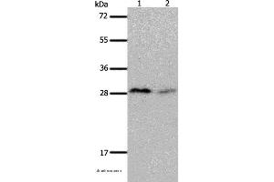 Western blot analysis of Mouse brain and kidney tissue, using KLK7 Polyclonal Antibody at dilution of 1:600 (Kallikrein 7 抗体)