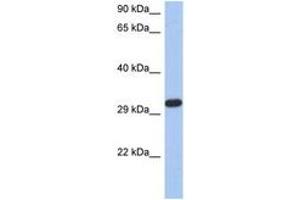 Image no. 1 for anti-Capping Protein (Actin Filament) Muscle Z-Line, alpha 3 (CAPZA3) (N-Term) antibody (ABIN6744292)