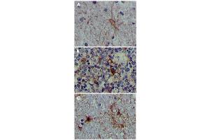 Immunohistochemical analysis of paraffin-embedded human brain tissue (A), lymphoid follicles tissue (B) and interbrain tissue (C), showing cytoplasmic localization. (S100A1 抗体)