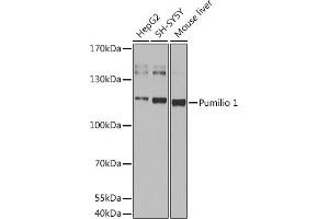 Western blot analysis of extracts of various cell lines, using Pumilio 1 antibody (ABIN6132539, ABIN6146494, ABIN6146496 and ABIN6217367) at 1:1000 dilution. (PUM1 抗体  (AA 1-130))