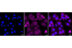 Immunocytochemical staining of HT- cells with Insulin receptor substrate 1 antibody (ABIN7799046), 1:1,000). (Recombinant IRS1 抗体)