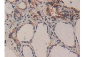 Detection of CASP3 in Human Thyroid Tissue using Polyclonal Antibody to Caspase 3 (CASP3) (Caspase 3 抗体  (AA 29-175))