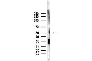 Western blot analysis of lysates from HepG2 cells(starvation,24h treatment), using CP Antibody at 1/1000 dilution.
