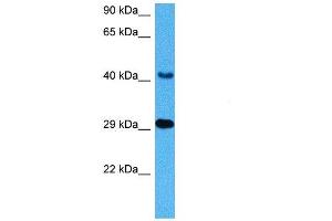 Host:  Mouse  Target Name:  CTSD  Sample Tissue:  Mouse Heart  Antibody Dilution:  1ug/ml