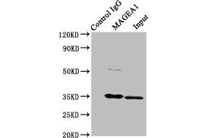 Immunoprecipitating MAGEA1 in Hela whole cell lysate Lane 1: Rabbit control IgG instead of ABIN7159251 in Hela whole cell lysate. (MAGEA1 抗体  (AA 1-309))