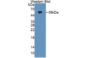 Western blot analysis of the recombinant protein. (Tenascin R 抗体  (AA 329-588))