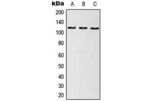 Western blot analysis of SNRP116 expression in HeLa (A), NIH3T3 (B), H9C2 (C) whole cell lysates.