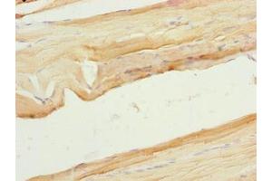 Immunohistochemistry of paraffin-embedded human skeletal muscle tissue using ABIN7175917 at dilution of 1:100 (xpr1 抗体  (AA 529-696))