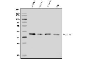 Western blot analysis of ZWINT using anti-ZWINT antibody (ABIN7599163).