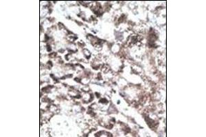 Immunohistochemistry (Paraffin-embedded Sections) (IHC (p)) image for anti-G Protein-Coupled Receptor 37 (Endothelin Receptor Type B-Like) (GPR37) (AA 217-246), (C-Term) antibody (ABIN390380)