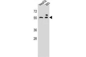 ZFP91 Antibody (Center) (AP54647PU-N ) western blot analysis in HepG2,293 cell line lysates (35 µg/lane). (ZFP91 抗体  (Middle Region))