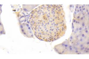 Immunohistochemistry (IHC) image for anti-Pyruvate Kinase, Liver and RBC (PKLR) (AA 114-323) antibody (ABIN7431305)