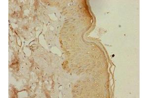 Immunohistochemistry of paraffin-embedded human skin tissue using ABIN7164417 at dilution of 1:100 (DTX2 抗体  (AA 1-280))