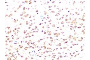 Immunohistochemistry of paraffin-embedded rat brain using Casein Kinase 2 beta (CSNK2B) (CSNK2B) Rabbit mAb (ABIN1680593, ABIN3019007, ABIN3019008 and ABIN7101698) at dilution of 1:100 (40x lens).