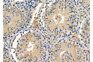 ABIN6257247 and ABIN6274671 at 1/100 staining Mouse testis tissue by IHC-P.