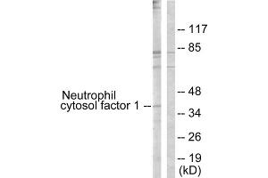 Western blot analysis of extracts from COS7 cells, treated with UV (15mins), using Neutrophil Cytosol Factor 1 (epitope around residue 304) antibody. (NCF1 抗体  (Ser304))