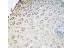 Immunohistochemistry of paraffin-embedded Human esophagus using GRPEL2 Polyclonal Antibody at dilution of 1:100 (40x lens). (GRPEL2 抗体)