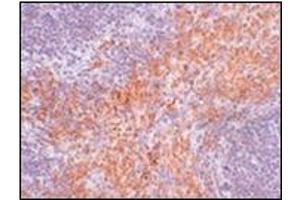 Immunohistochemistry of RIPK1 in mouse kidney tissue with this product at 2. (RIPK1 抗体  (N-Term))