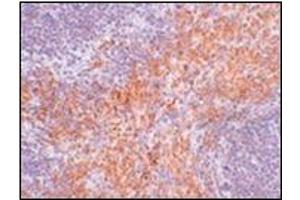 Immunohistochemistry of RIPK1 in mouse kidney tissue with this product at 2.